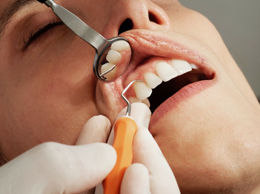 Pas dine tandlægebesøg og få sunde tænder